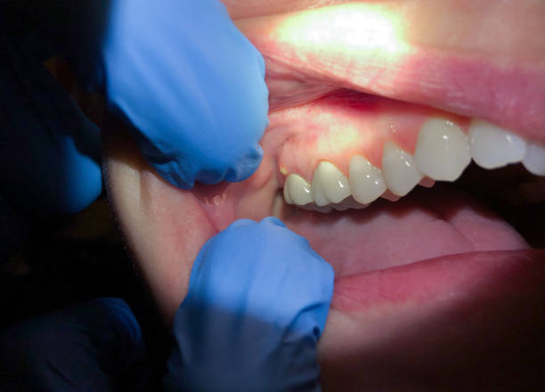 Best Weekend Emergency Dentist in White Oak, MS